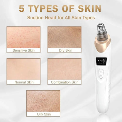 PoreCleaner Pro™ Plus - Spa level clean in 5 mins 💆‍♀️✨