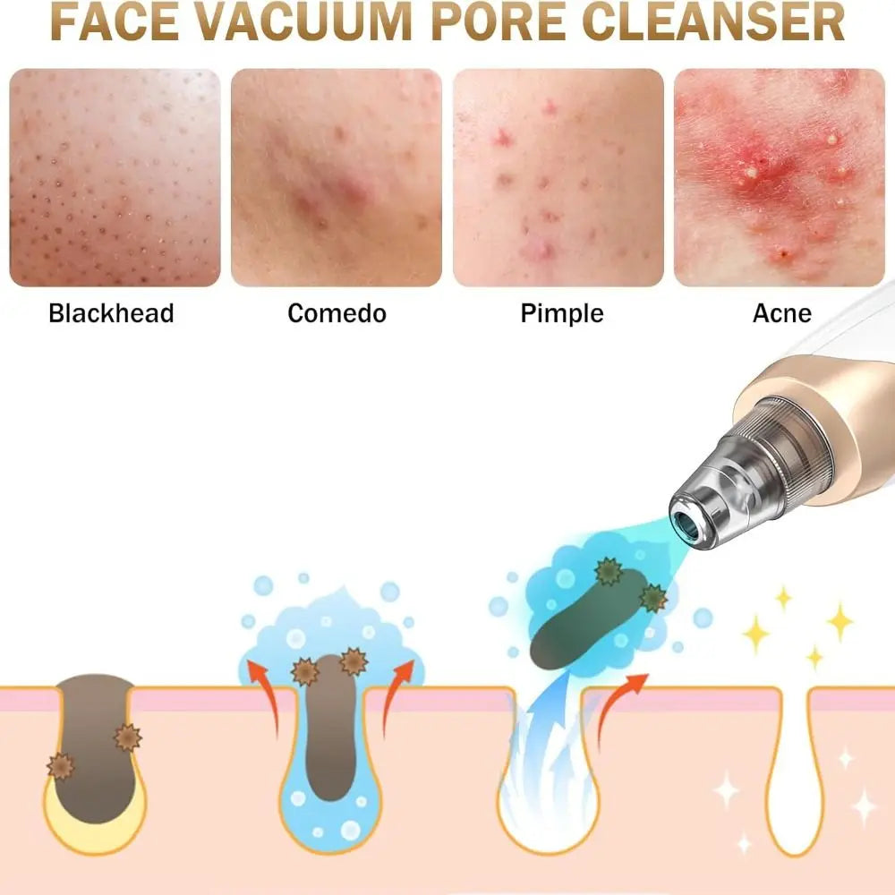 PoreCleaner Pro™ Plus - Spa level clean in 5 mins 💆‍♀️✨