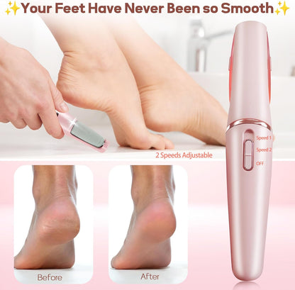 HeelGlow Pro 💖– Rechargeable Electric Callus Remover to Get Silky-Smooth Feet 🌸👣